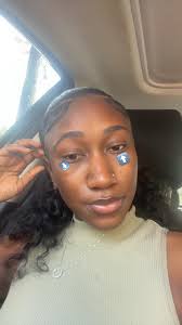 Has anyone experienced swelling after BBL and Jay plasma surgery?