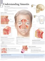 Image result for Sinusitis Prediction Rule