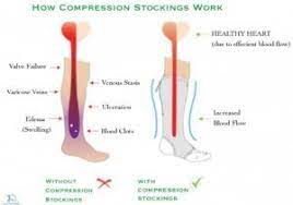 Pin On How To Relief