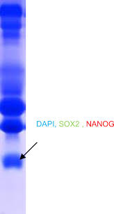 Harvey norman, australia's leading retailer has a huge range of products now available to buy online. 10th Anniversary Of The European Association For Predictive Preventive And Personalised 3p Medicine Epma World Congress Supplement 2020 Springerlink
