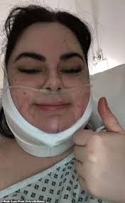 I paid £5,000 for liposuction to tackle my double chin