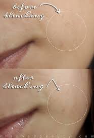 Foods high on phytoestrogen and certain minerals too help. How I Manage Unwanted Facial Hair Slashed Beauty Facial Hair Bleach Unwanted Facial Hair Facial Hair