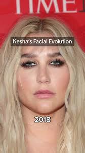 The Evolution of Kesha's Face: A TikTok Journey