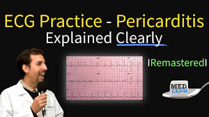 Das ekg hat jedoch mit der einführung von invasivem hämodynamischen monitoring. Ecg Interpretation Practice Pericarditis On Ekg Explained Youtube