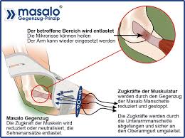Die beliebtesten epicondylitis spange im vergleich! Masalo Manschette Endlich Hilfe Bei Tennisarm Golferarm Mausarm