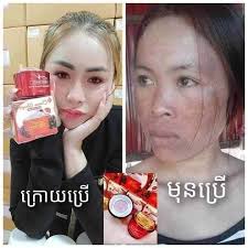 ជាំតិច+ជាំច្រើន+ជាំយូរខែយូរឆ្នាំ ស្បែកមុខអាឡាក់ស៊ី-ស្បែកមុខស្ងួតគ្មានសំណើម  បងប្អូនទាំងអស់គ្នាប្រើជាមួយគ្រីមទំពាំងបាយជូរ គុណភាព ...