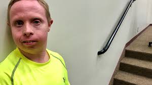 A man with Down syndrome pretended to be robbed