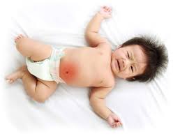 Learn what causes diarrhea, how to safely keep your child hydrated, and when to call the doctor. Dos And Don Ts Of Diarrhoea Positive Parenting