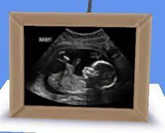 Sep 24, 2018 · hey guys! Ultrasound Mod Sims 4