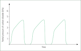 Image result for End-Tidal O2