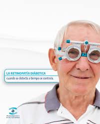 Oftalmológica Láser Celaya (@oftalmologicalasercelaya) • Instagram photos  and videos