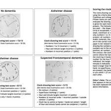 30 drawing yes 1:00, 3:00, 9:15, 7:00 subject asked to denote four different times. Clock Drawings And Test Scores For Patients Without Dementia And Those Download Scientific Diagram