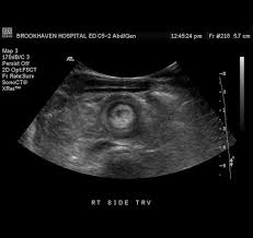 Pin On Sonography