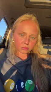 Emma with A Rejected Liver Transplant Now