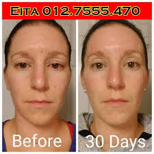 Butuh waktu, namun menjadi solusi praktis yang kini ditempuh banyak orang, terutama wanita. Youth Shaklee Produk Putihkan Kulit Terbaik Cepat Selamat Bebas Merkuri Testimoni Youth3 Youth Younger Looking Skin Anti Aging Regimen
