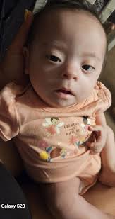 Will Nystagmus cause vision challenges in children?