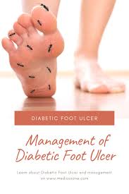 Management Of Diabetic Foot Ulcer