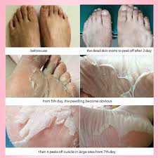 .the original baby foot peel gently removes unwanted dead skin. Information Of Efero Foot Mask Peeling Dead Skin Smooth Exfoliating Socks Feet Mask Baby Foot Peeling Mask Cream Heels For Pedicure Socks 2pair Our Mister Benson