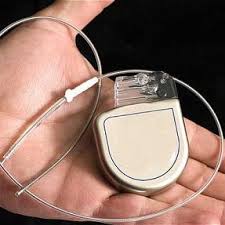 Image result for Internal Cardiac Defibrillator