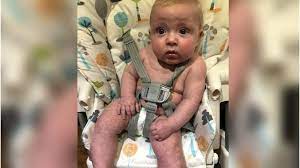 Once your baby's umbilical cord has fallen off and after a boy's circumcision has healed, you can give your baby a tub bath. Covid 19 Baby S Mother Issues Mottled Skin Warning Bbc News