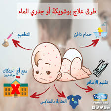 بعض الأمهات كتسائلوا واش كاين علاج فوري لمرض جدري الماء بوشويكة الجواب هو لا ولكن كاين العلاجات لتخفيف الأعراض وتقليل من فرص Baby Food Recipes Baby Halal