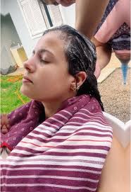 Lavagem de Cabelo Pós Cirurgia: Dicas e Cuidados