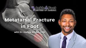 Image result for Metatarsal