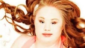 Jovem com síndrome de down vê futuro na carreira de modelo