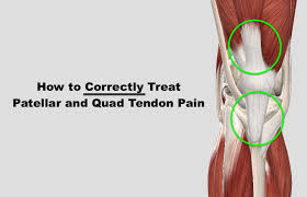 I discuss what treatments you should do in the acute phase but also what. Fixing Patellar Quad Tendon Pain Squat University