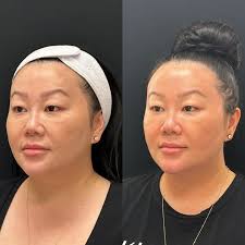 Michelle Lora (@aesthetics_nj) • Instagram photos and videos