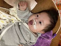 ファロー四徴症とBTシャント術 | ダウン症&ファロー四徴症(先天性心疾患)・めいちゃんケアのブログ