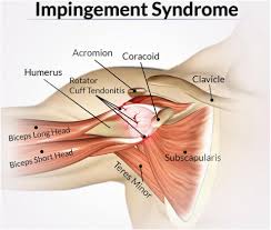 Related online courses on physioplus. Shoulder Pain Rejuvayou Medical
