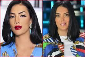 آخرهم «حورية فرغلي».. فنانات نادمات على عمليات التجميل | بوابة أخبار اليوم  الإلكترونية