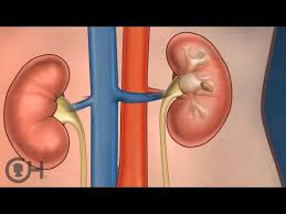 Explaining Kidney Stones In Children 1 Of 5 Youtube