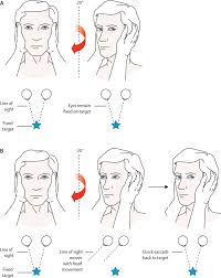 Image result for Cerebellar Function Test