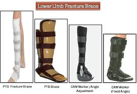 The ptb afo is designed to transfer weight from the foot/ankle complex to the patella tendon as well as to the calf area through hydrostatic compression. Orthotic Prosthetic Orthopedic Diabetic Creative Orthotic And Prosthetic Solutions