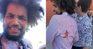 Poslanec za top 09 dominik feri dnes navečer oznámil, že se po kauze, která se kolem něj rozjela, rozhodl rezignovat na mandát poslance. Feri Pod Tihou Vysetrovani Rekl Vic O Rane Na Zadech Nuz V Ni Nehledejte Blesk Cz