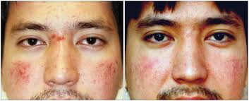 Alex — VILLANI MEDICAL