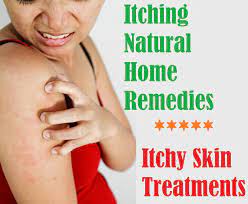 Itching Natural Home Remedies Itchy Skin Treatments Itchy Skin Treatment Itchy Skin Remedy Skin Remedies