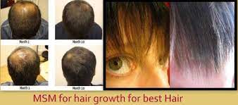 Msm truly has helped me more than double my rate of hair growth and has been an absolute game changer in my hair journey. Is Msm Good For Hair Growth I Fashion Styles