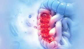 Although colon cancer (also referred to as colorectal cancer) can develop at any age in adults, it typically affects women and men who are age 50+, who have an increased risk of developing colon cancer. A Look At Colorectal Colon Cancer In Singapore 2020 Parkway Cancer Centre Singapore