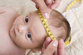 Kopfumfang Beim Kinderarzt Medizinisches Baby Swissmom Ch