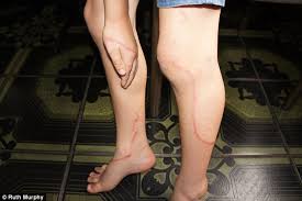 Resultado de imagen para 6. Irukandji: