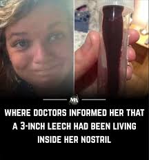 She had daily nosebleeds 😳 Full story below👇👇👇