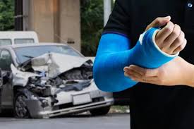 Car Accident Recovery Guide | Recovery For Car Accidents