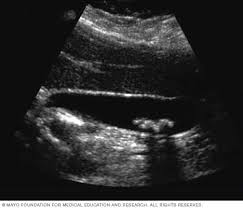 Image result for Ultrasound