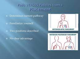 Paddle electrodes, which were the first type developed, come without gel, and must have the gel applied in a separate step. Paediatric Defibrillation Ppt Download