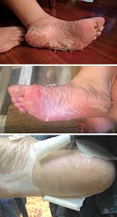 But after making a lot of researches, we came across that listerine is the best product. Foot Soak For Dead Skin That Actually Works