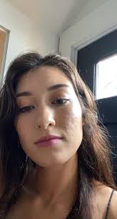 Looking for products that can help with acne scars and texture. Trying  anything before lasers! : r/SkincareAddicts