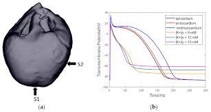 Applied Sciences | Free Full-Text | Effects Of Increased Extracellular  Potassium Concentration Induced By Ischemia On The Vulnerability Of  Ventricular Arrhythmias And The Regularity Of Related Ventricular  Tachycardia